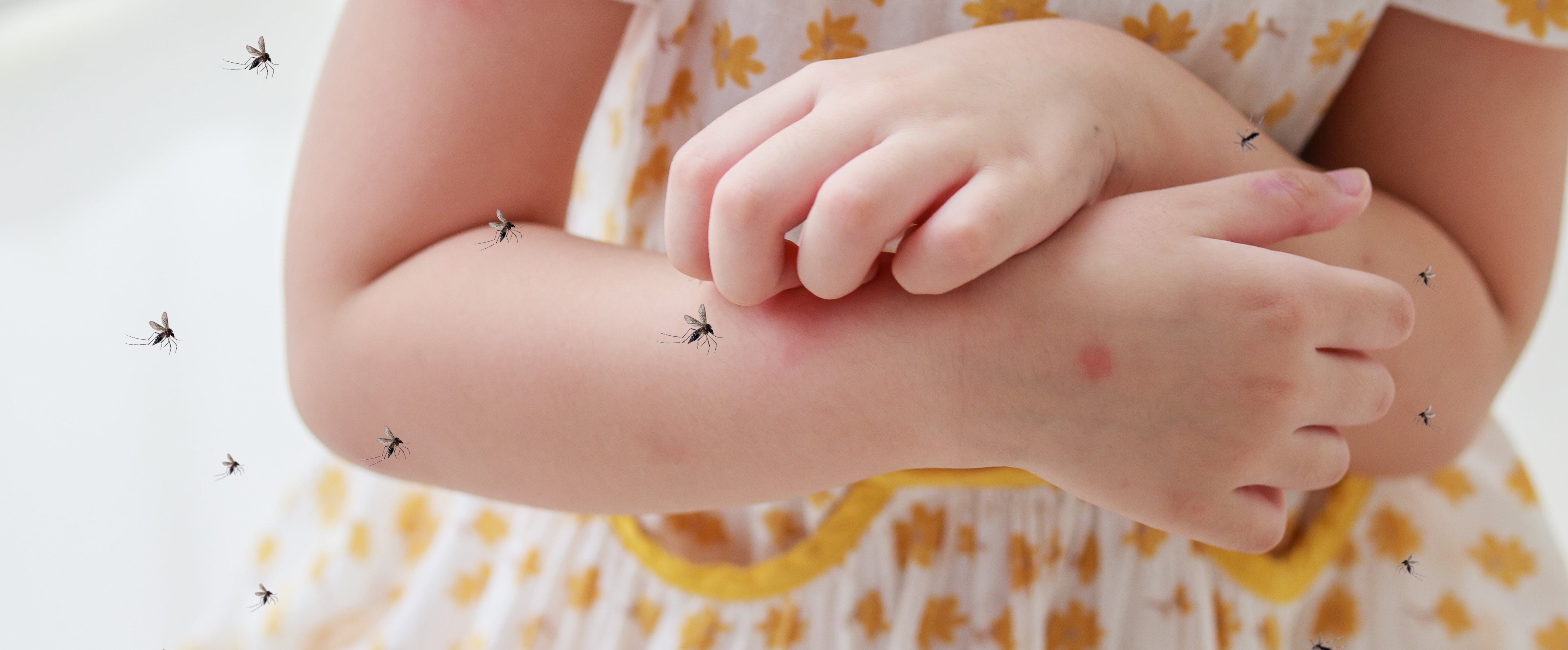 Instant and Safe Itch Relief: A Growing Trend Among Modern Families