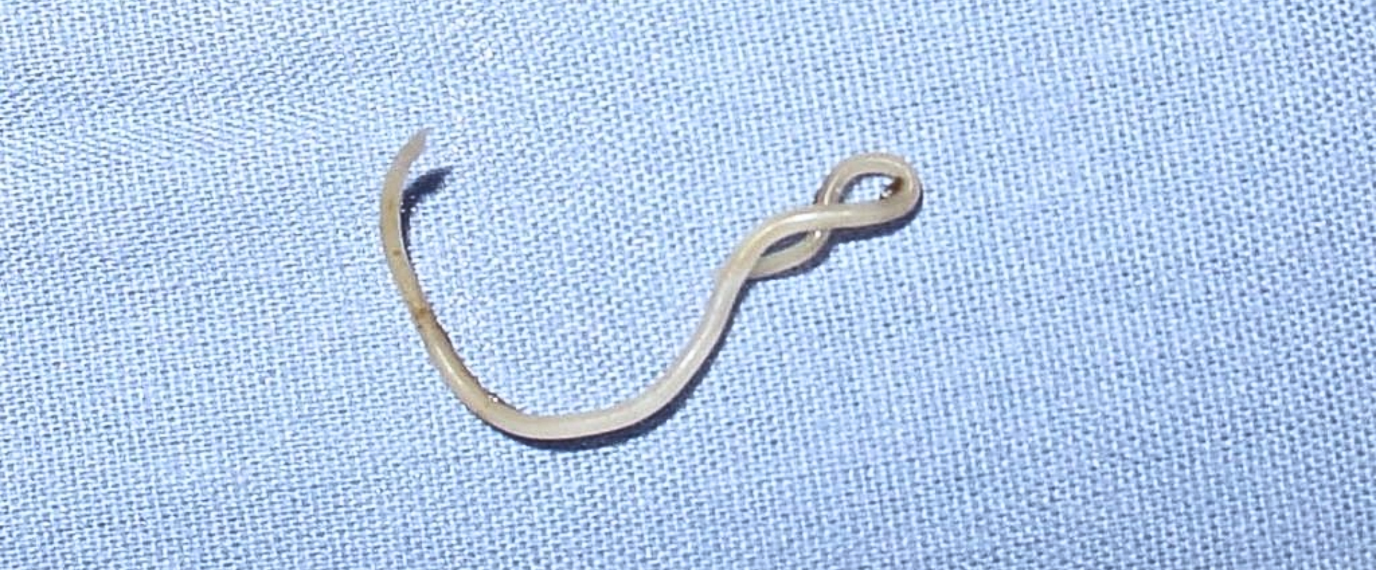 Worm Infections in Children: Causes, Symptoms, Treatment and Prevention