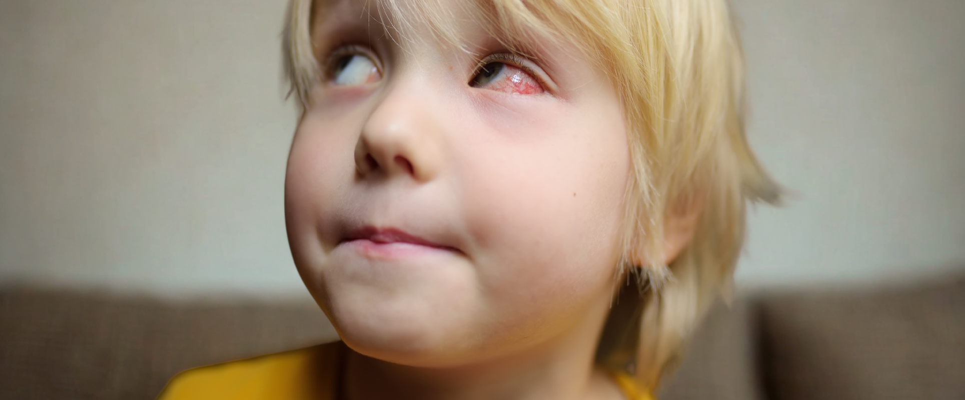 Conjunctivitis (Pink Eye) in Children: Symptoms, Causes, Treatment and Prevention