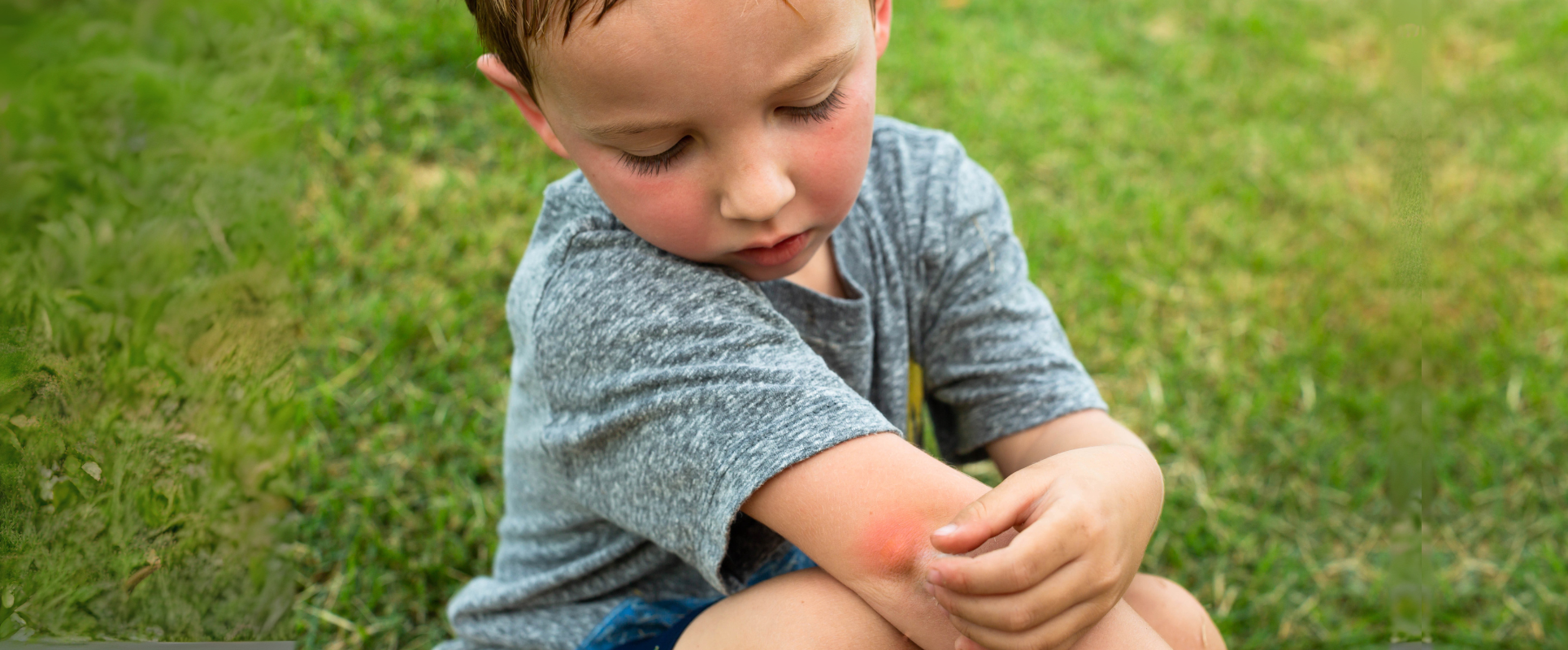 Quick Relief and Prevention of Insect Bites in Children: A Parent’s Guide